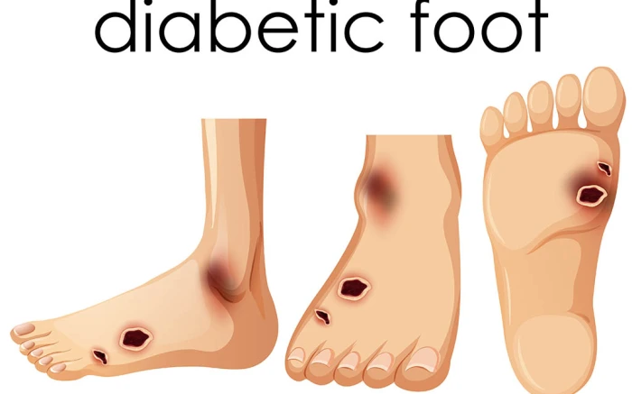 foot doctor dubai
