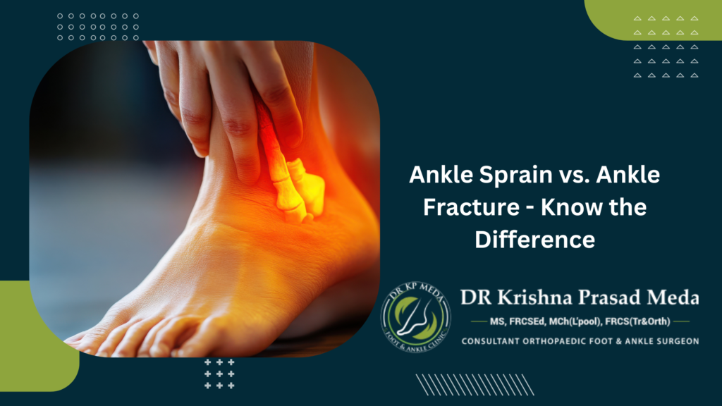 ankle fracture vs ankle sprain