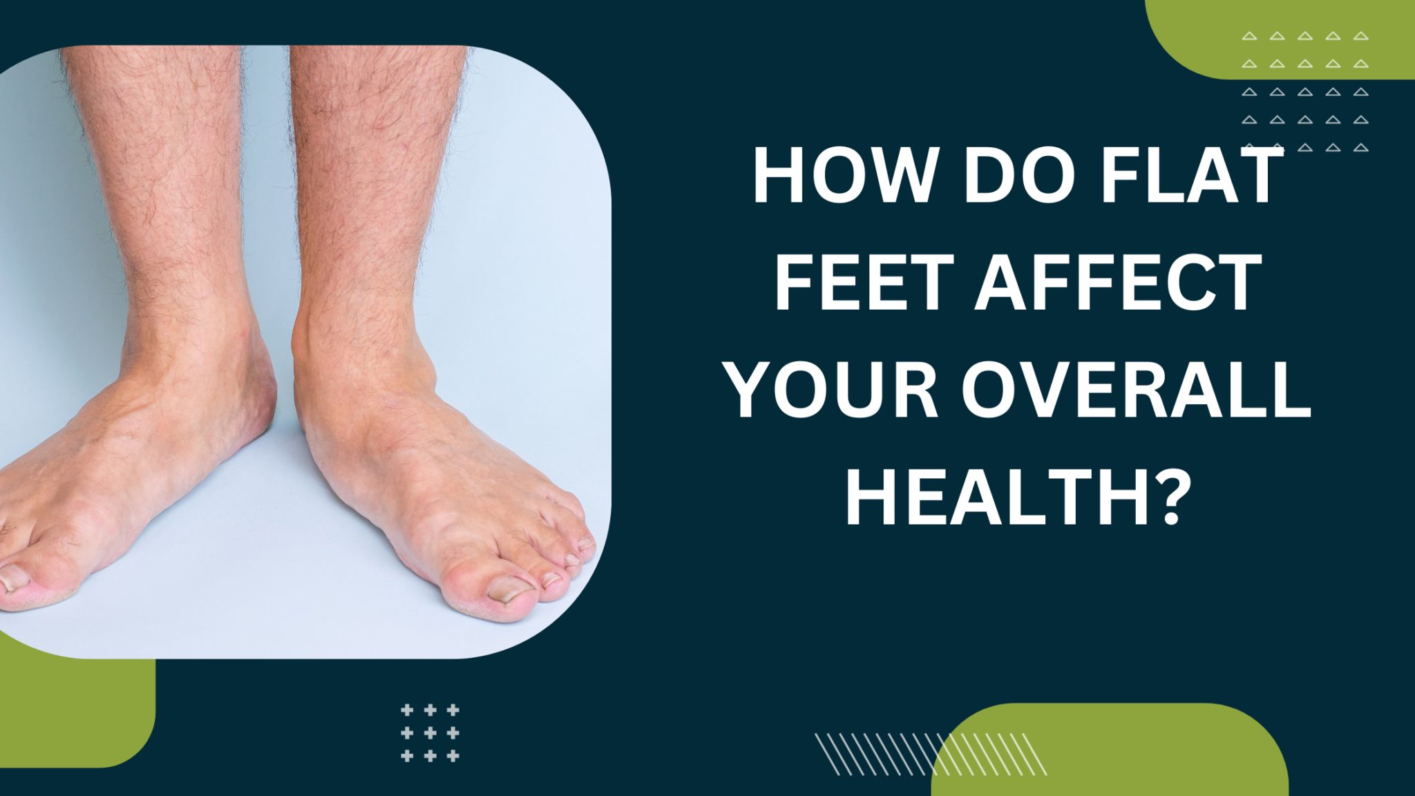 How Do Flat Feet Affect Your Overall Health?