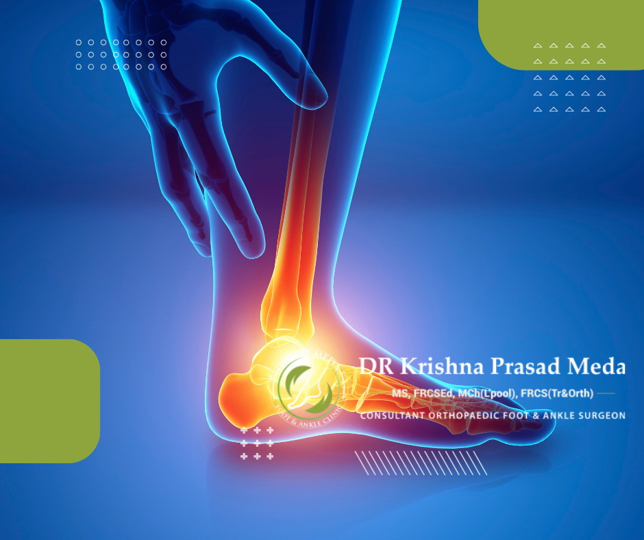 inner arch foot pain