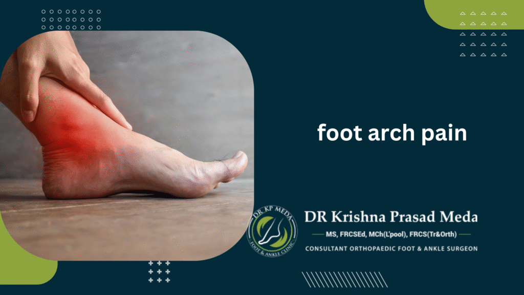 foot arch pain