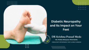 Understanding Diabetic Neuropathy and Its Impact on Your Feet