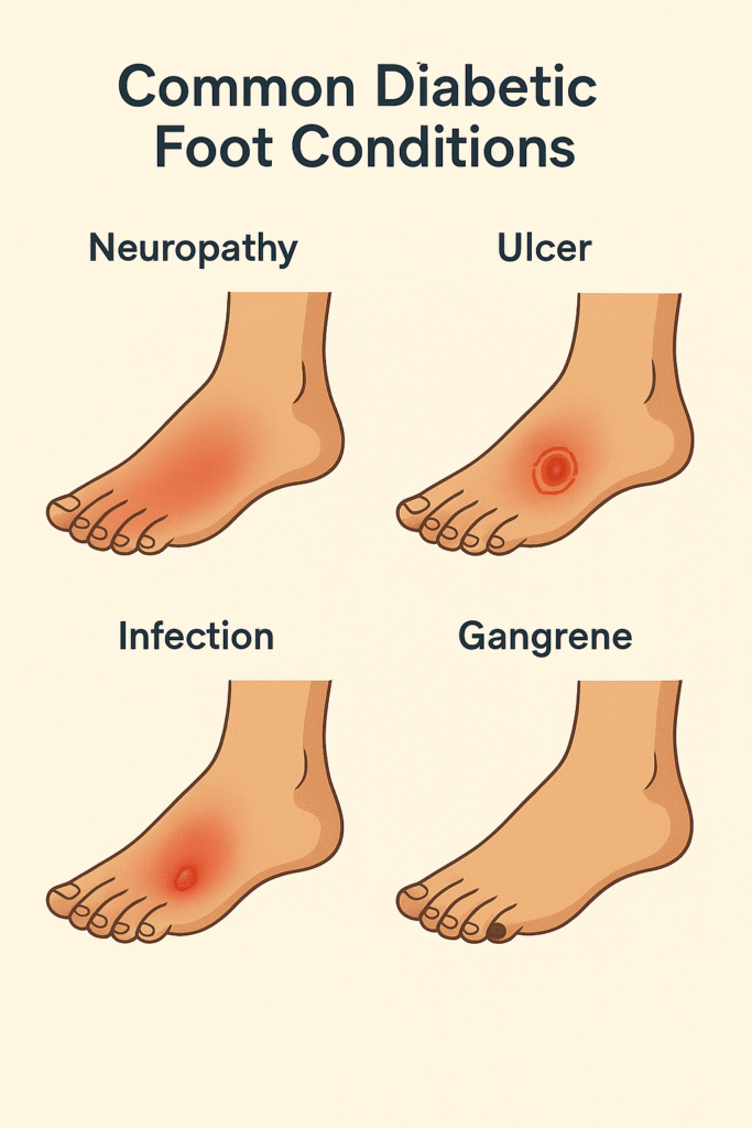 the common diabetic foot conditions