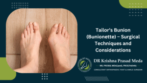 Tailor’s Bunion (Bunionette) – Surgical Techniques and Considerations