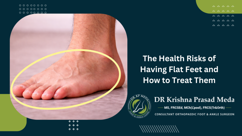 The Health Risks of Having Flat Feet and How to Treat Them