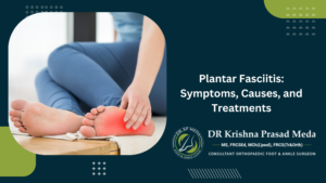 Plantar Fasciitis: Symptoms, Causes, and Treatments