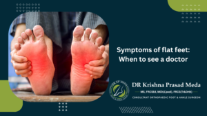 Symptoms of flat feet: When to see a doctor