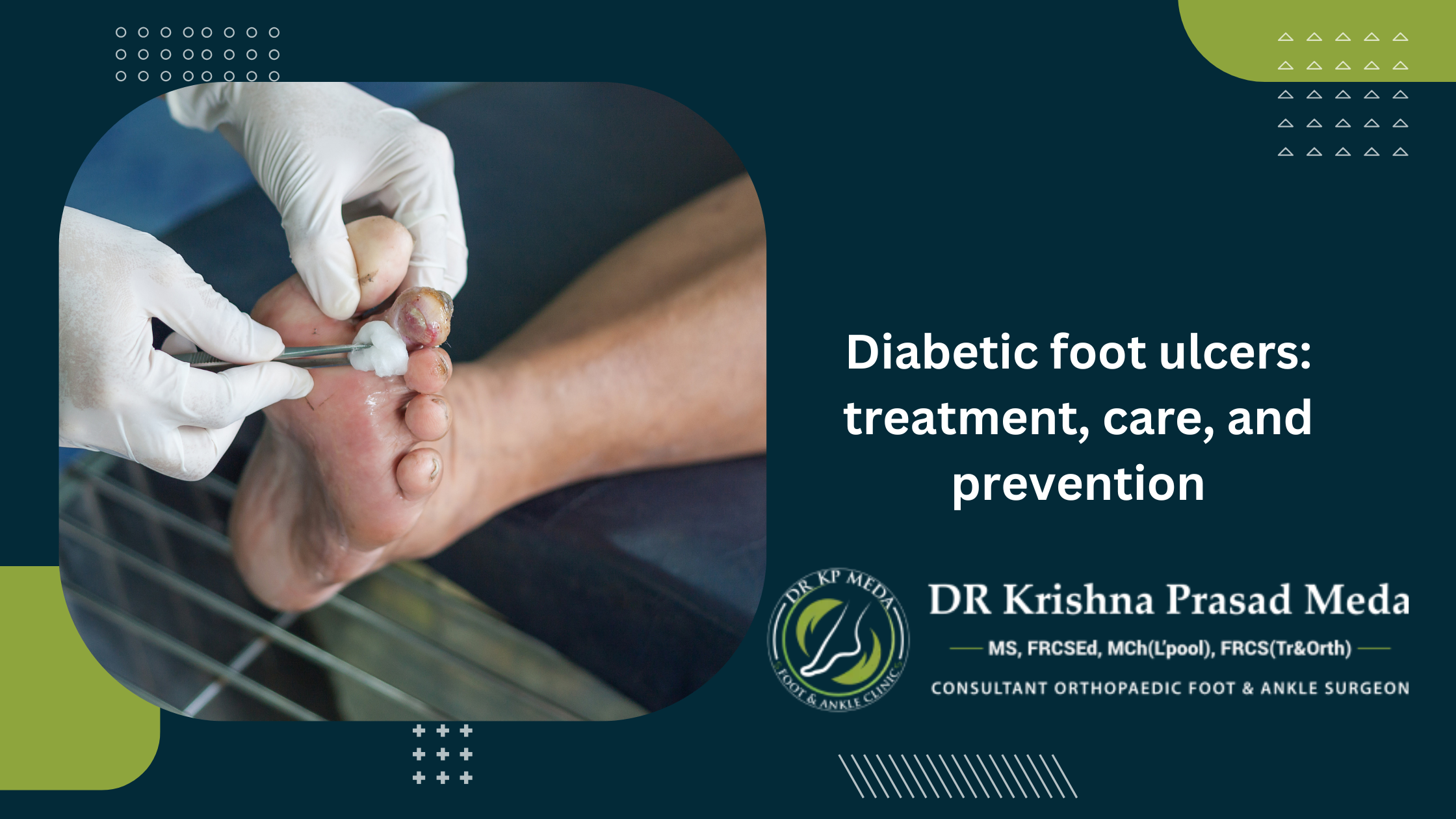 Diabetic foot ulcers