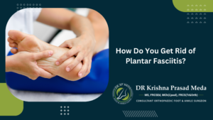 How Do You Get Rid of Plantar Fasciitis